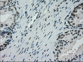 IHC of paraffin-embedded prostate tissue using anti-SILV mouse monoclonal antibody. (Dilution 1:50).