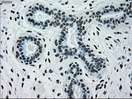 IHC of paraffin-embedded breast tissue using anti-SILV mouse monoclonal antibody. (Dilution 1:50).