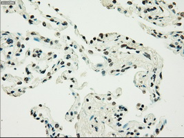 IHC of paraffin-embedded lung tissue using anti-SILV mouse monoclonal antibody. (Dilution 1:50).