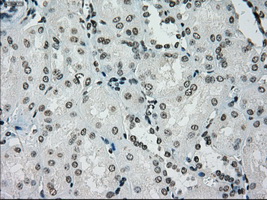 IHC of paraffin-embedded Kidney tissue using anti-SILV mouse monoclonal antibody. (Dilution 1:50).