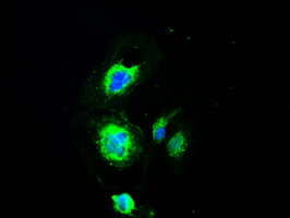 Anti-SILV mouse monoclonal antibody immunofluorescent staining of COS7 cells transiently transfected by pCMV6-ENTRY SILV.