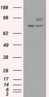 HEK293T cells were transfected with the pCMV6-ENTRY control (Left lane) or pCMV6-ENTRY SILV (Right lane) cDNA for 48 hrs and lysed. Equivalent amounts of cell lysates (5 ug per lane) were separated by SDS-PAGE and immunoblotted with anti-SILV.
