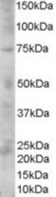 Antibody (1 ug/ml) staining of Human Skin lysate (35 ug protein in RIPA buffer). Primary incubation was 1 hour. Detected by chemiluminescence.
