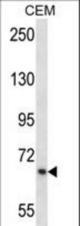 SILV Antibody western blot of CEM cell line lysates (35 ug/lane). The SILV antibody detected the SILV protein (arrow).