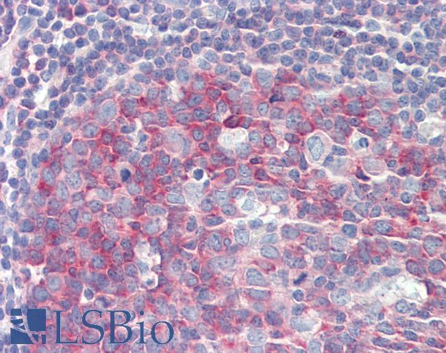 Anti-PMEL / SILV / gp100 antibody IHC staining of human tonsil. Immunohistochemistry of formalin-fixed, paraffin-embedded tissue after heat-induced antigen retrieval.