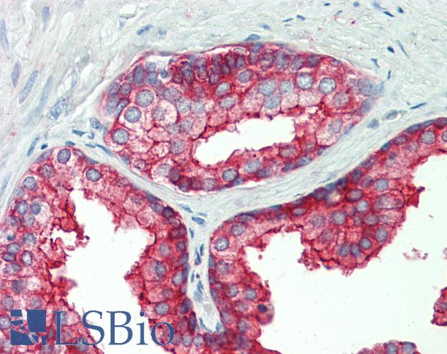 Anti-PMEL / SILV / gp100 antibody IHC staining of human prostate. Immunohistochemistry of formalin-fixed, paraffin-embedded tissue after heat-induced antigen retrieval. Antibody LS-B11136 concentration 10 ug/ml.