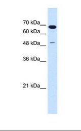 HepG2 cell lysate. Antibody concentration: 1.25 ug/ml. Gel concentration: 12%.