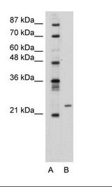 Transfected 293T Cell Lysate