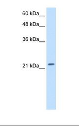 Transfected 293T cell lysate. Antibody concentration: 2.5 ug/ml. Gel concentration: 12%.