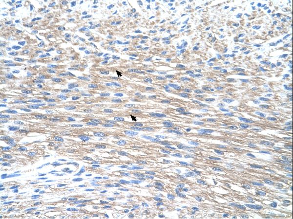 PMF1 antibody LS-C30487 was used in IHC to stain formalin-fixed, paraffin-embedded human heart.