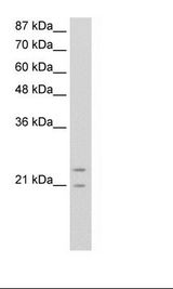 Transfected 293T Cell Lysate