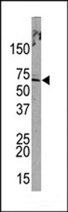 Western blot of anti-PML Sumoylation Site Antibody in HeLa cell line lysates (35 ug/lane). PML (arrow) was detected using the purified antibody.