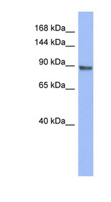 PML antibody LS-C110435 Western blot of ACHN lysate.