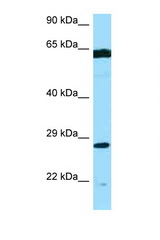 PMM2 antibody LS-C146561 Western blot of MCF7 Cell lysate. Antibody concentration 1 ug/ml.