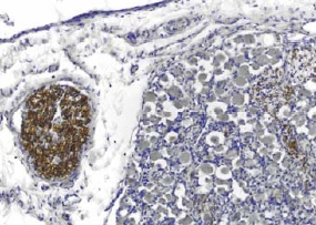 Staining of PMP22 (brown) in dorsal root ganglion and spinal roots in 20 week fetal spinal cord preparation from rhesus monkey.