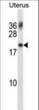 PMP22 Antibody western blot of human normal Uterus tissue lysates (35 ug/lane). The PMP22 antibody detected the PMP22 protein (arrow).