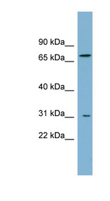 ABCD3 / PMP70 antibody LS-C110804 Western blot of Fetal Small Intestine lysate.