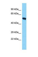 Western blot of Human MCF7. PMPCA antibody dilution 1.0 ug/ml.