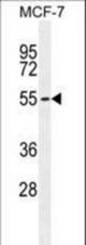 PMPCA Antibody western blot of MCF-7 cell line lysates (35 ug/lane). The PMPCA antibody detected the PMPCA protein (arrow).