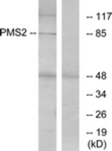 Western blot of extracts from HeLa cells, using PMS2 Antibody. The lane on the right is treated with the synthesized peptide.