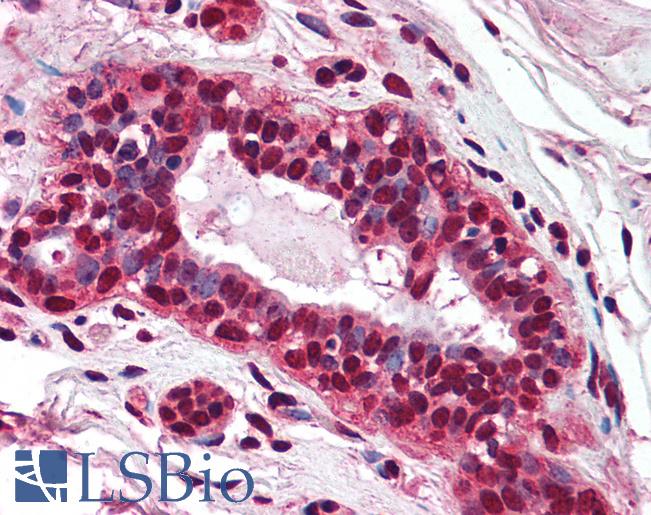 Anti-PMS2 antibody IHC of human breast. Immunohistochemistry of formalin-fixed, paraffin-embedded tissue after heat-induced antigen retrieval. Antibody LS-B1980 concentration 5 ug/ml.