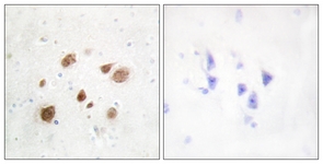 IHC of paraffin-embedded human brain tissue, using CaMK1-beta Antibody. The picture on the right is treated with the synthesized peptide.
