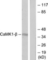 Western blot of extracts from LOVO cells, treated with H2O2 100 uM 30', using CaMK1-beta Antibody. The lane on the right is treated with the synthesized peptide.