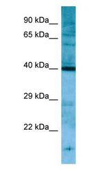 PNCK antibody Western Blot of Rat Stomach.