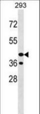 PNCK Antibody western blot of 293 cell line lysates (35 ug/lane). The PNCK antibody detected the PNCK protein (arrow).