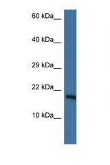 PNKD antibody LS-C135170 Western blot of Mouse Heart lysate. Antibody concentration 1 ug/ml.