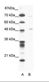 A: Marker, B: Jurkat Cell Lysate