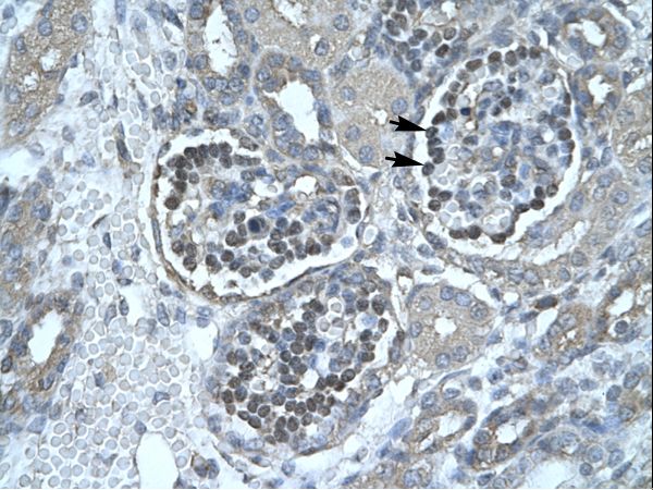 PNLIP / Pancreatic Lipase antibody LS-C31105 was used in IHC to stain formalin-fixed, paraffin-embedded human kidney.
