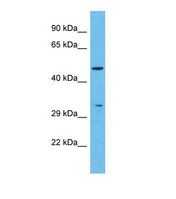 Western blot of Human Stomach Tumor. PNLIPRP2 antibody dilution 1.0 ug/ml.