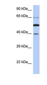 PNMA3 antibody LS-C111586 Western blot of 721_B cell lysate.