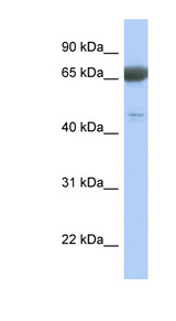 PNMA3 antibody LS-C111587 Western blot of Fetal Lung lysate.