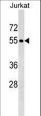 PNMA3 Antibody western blot of Jurkat cell line lysates (35 ug/lane). The PNMA3 antibody detected the PNMA3 protein (arrow).