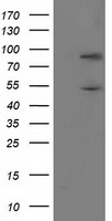 HEK293T cells were transfected with the pCMV6-ENTRY control (Left lane) or pCMV6-ENTRY PNMA3 (Right lane) cDNA for 48 hrs and lysed. Equivalent amounts of cell lysates (5 ug per lane) were separated by SDS-PAGE and immunoblotted with anti-PNMA3.