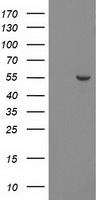 HEK293T cells were transfected with the pCMV6-ENTRY control (Left lane) or pCMV6-ENTRY PNMA3 (Right lane) cDNA for 48 hrs and lysed. Equivalent amounts of cell lysates (5 ug per lane) were separated by SDS-PAGE and immunoblotted with anti-PNMA3.