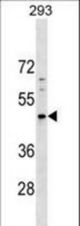 PNMA5 Antibody western blot of 293 cell line lysates (35 ug/lane). The PNMA5 antibody detected the PNMA5 protein (arrow).