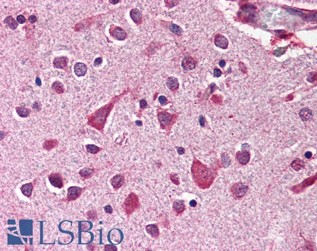 Anti-MCL1 antibody IHC of human brain, cortex. Immunohistochemistry of formalin-fixed, paraffin-embedded tissue after heat-induced antigen retrieval. Antibody LS-B586 concentration 2 ug/ml.