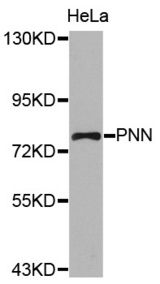 Western blot analysis of extracts of HeLa cell lines, using PNN antibody.