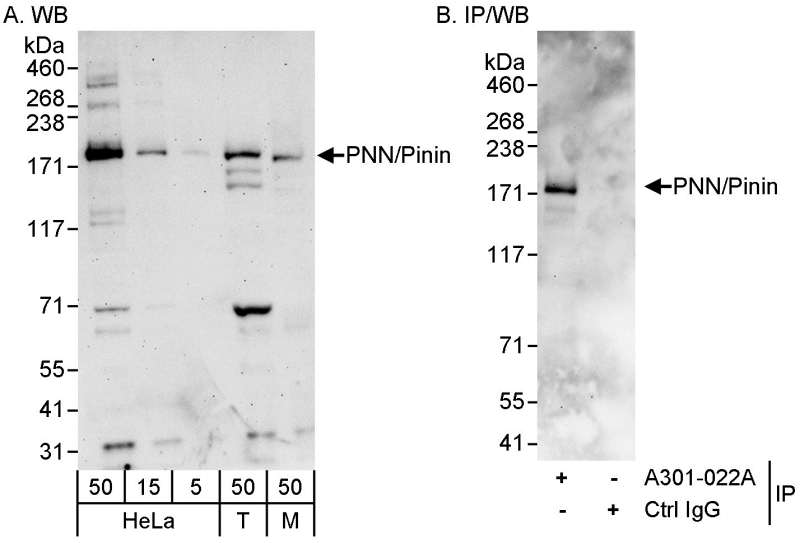 Detection of Human and Mouse PNN/Pinin by Western Blot (h&m) and Immunoprecipitation (h). Samples: Whole cell lysate from HeLa (5, 15 and 50 ug for WB; 1 mg for IP, 20% of IP loaded), 293T (T; 50 ug) and mouse NIH3T3 (M; 50 ug) cells. Antibody: Affinity purified rabbit anti-PNN/Pinin antibody used for WB at 0.1 ug/ml (A) and 1 ug/ml (B), and used for IP at 3 ug/mg lysate. Detection: Chemiluminescence with exposure times of 3 minutes (A) and 30 seconds (B).