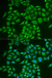Immunofluorescence analysis of U2OS cell using PNOC antibody. Blue: DAPI for nuclear staining.