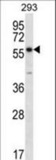 PNPLA1 Antibody western blot of 293 cell line lysates (35 ug/lane). The PNPLA1 antibody detected the PNPLA1 protein (arrow).