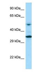 PNPLA2 / ATGL antibody Western Blot of MCF7 Cell. Antibody dilution: 1 ug/ml.