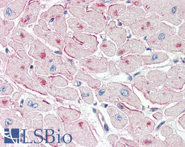 Anti-PNPLA2 / ATGL antibody IHC of human heart. Immunohistochemistry of formalin-fixed, paraffin-embedded tissue after heat-induced antigen retrieval. Antibody LS-B2404 concentration 5 ug/ml.