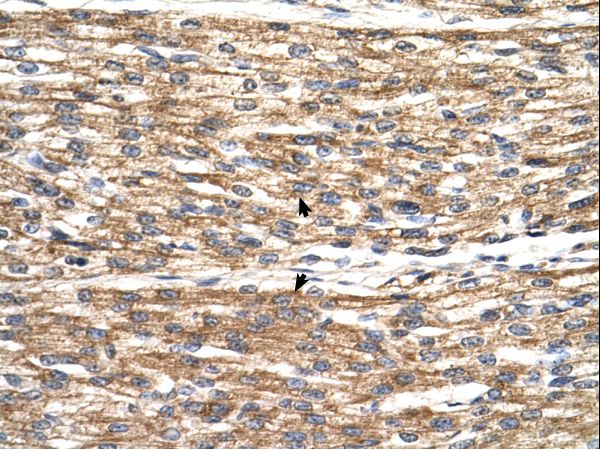 PNPLA3 antibody LS-C81325 was used in IHC to stain formalin-fixed, paraffin-embedded human heart.