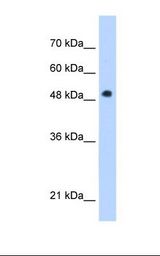 Jurkat cell lysate. Antibody concentration: 1.0 ug/ml. Gel concentration: 12%.