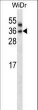 PNPLA4 Antibody western blot of WiDr cell line lysates (35 ug/lane). The PNPLA4 antibody detected the PNPLA4 protein (arrow).