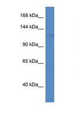 PNPLA6 antibody LS-C135198 Western blot of Mouse Heart lysate. Antibody concentration 1 ug/ml.